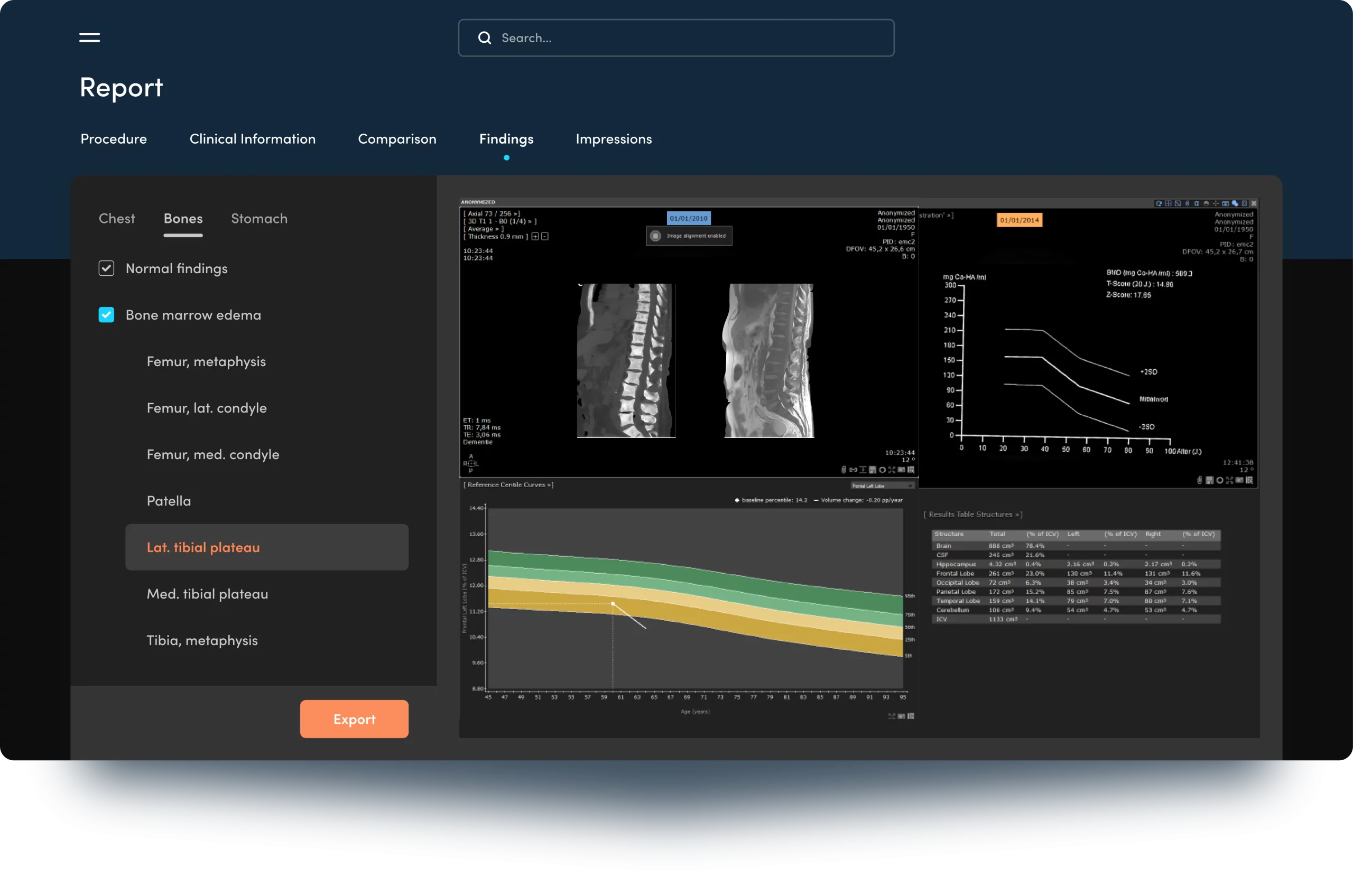 Streamlined Integration of Radiology and Pathology Reports