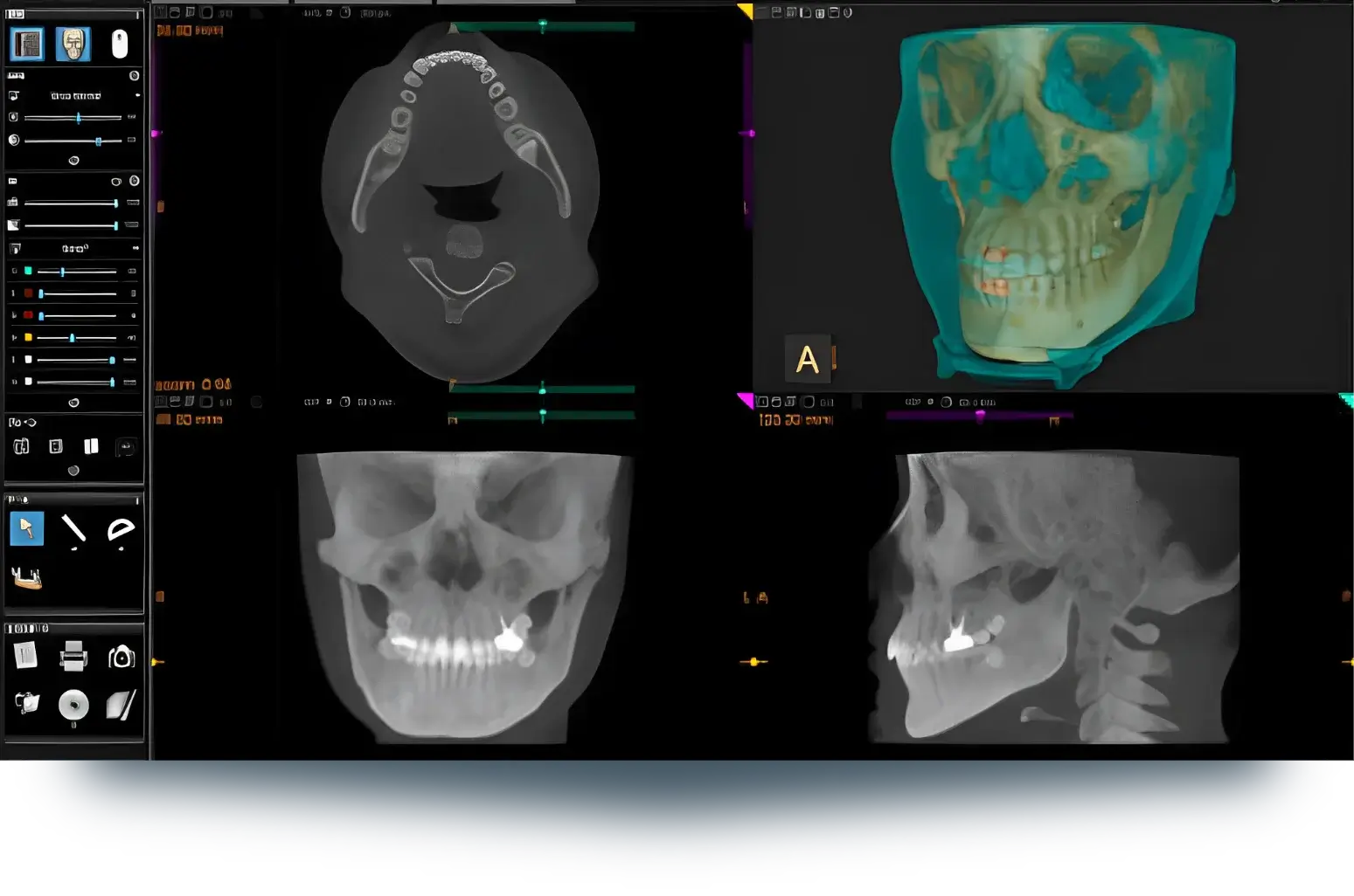 Digitalization of Radiology Guidelines
